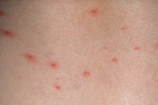Small red spots on white skin.
